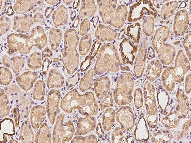 MFN2 Antibody in Immunohistochemistry (Paraffin) (IHC (P))