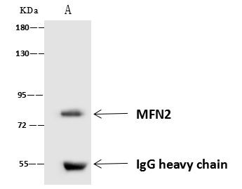 MFN2 Antibody in Immunoprecipitation (IP)