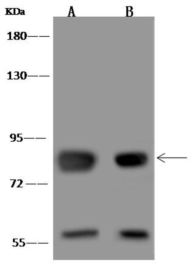 MFN2 Antibody in Western Blot (WB)