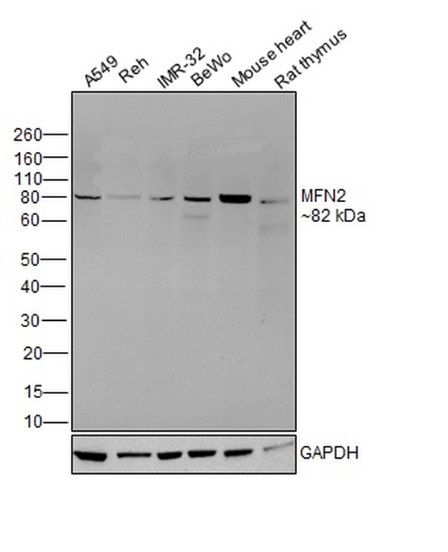 MFN2 Antibody in Western Blot (WB)