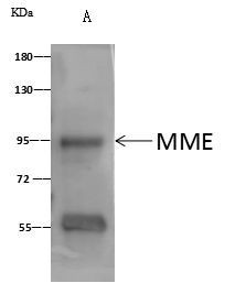 CD10 Antibody in Immunoprecipitation (IP)