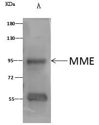 CD10 Antibody in Immunoprecipitation (IP)