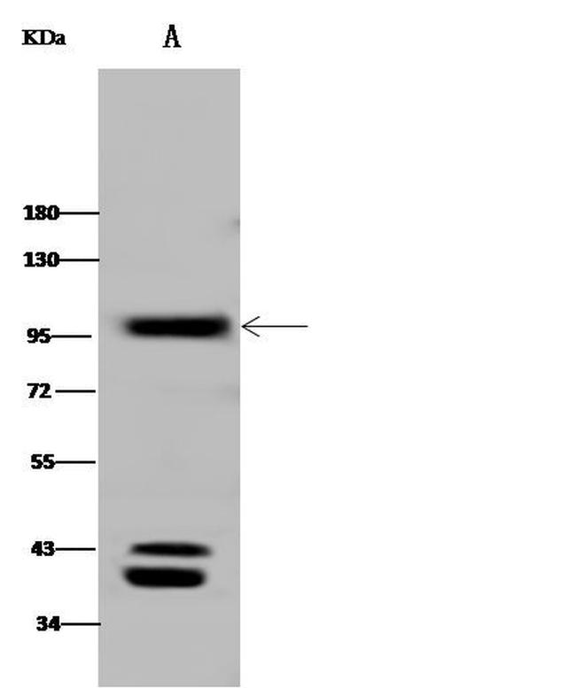 CD10 Antibody in Western Blot (WB)