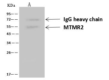 MTMR2 Antibody in Immunoprecipitation (IP)