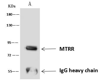 MTRR Antibody in Immunoprecipitation (IP)