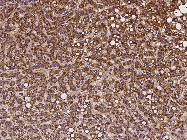 NARS2 Antibody in Immunohistochemistry (Paraffin) (IHC (P))