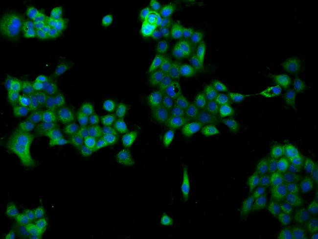 NDUFB6 Antibody in Immunocytochemistry (ICC/IF)