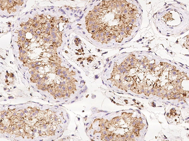 NDUFS1 Antibody in Immunohistochemistry (Paraffin) (IHC (P))