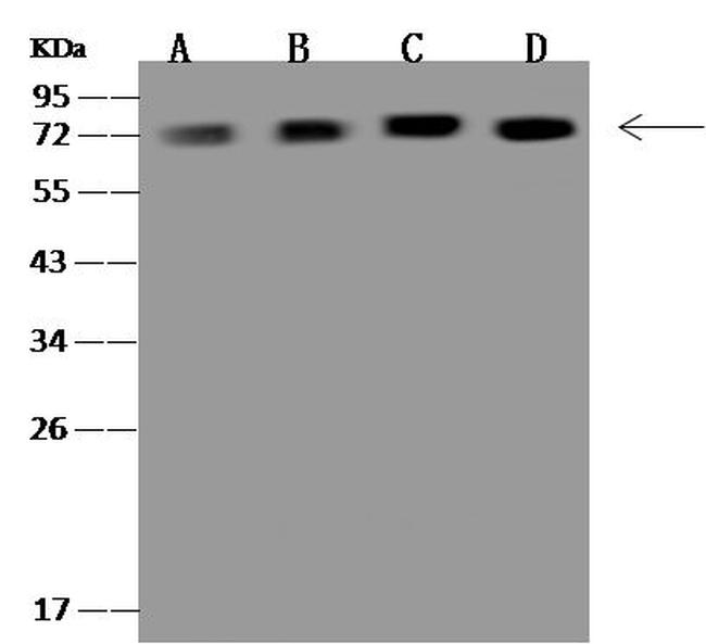 NDUFS1 Antibody in Western Blot (WB)