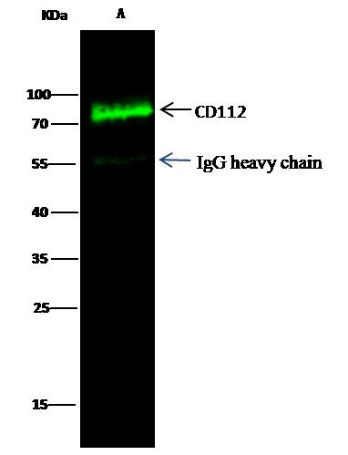 Nectin 2 Antibody in Immunoprecipitation (IP)