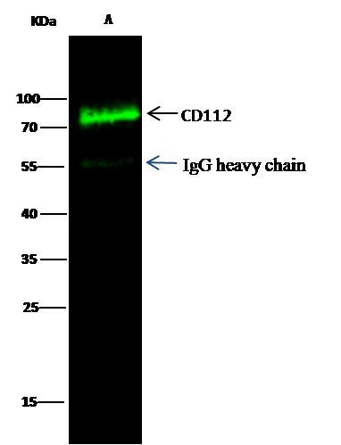 Nectin 2 Antibody in Immunoprecipitation (IP)