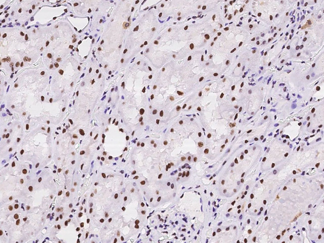 NPM1 Antibody in Immunohistochemistry (Paraffin) (IHC (P))