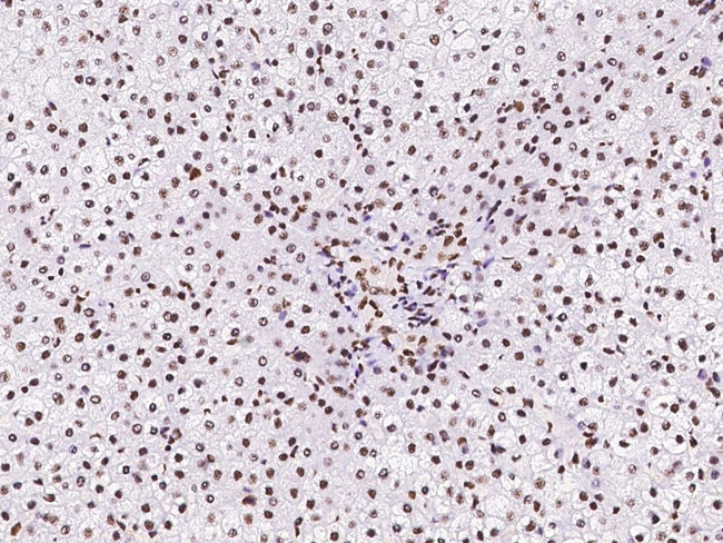 NPM1 Antibody in Immunohistochemistry (Paraffin) (IHC (P))