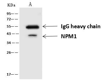 NPM1 Antibody in Immunoprecipitation (IP)