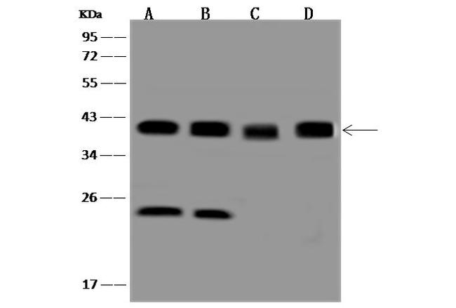 NPM1 Antibody in Western Blot (WB)