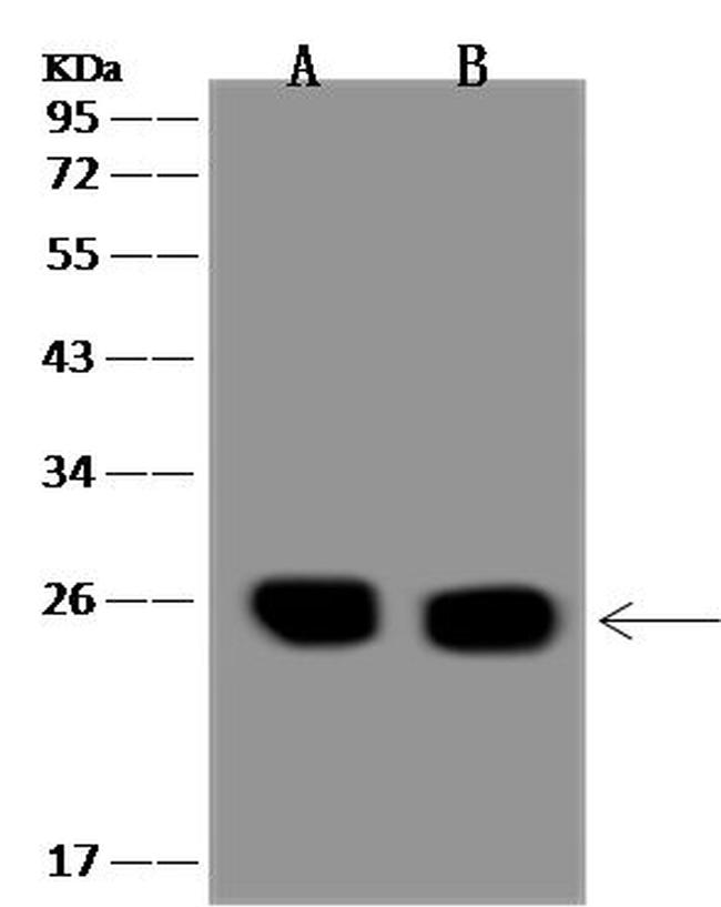 NTMT1 Antibody in Western Blot (WB)