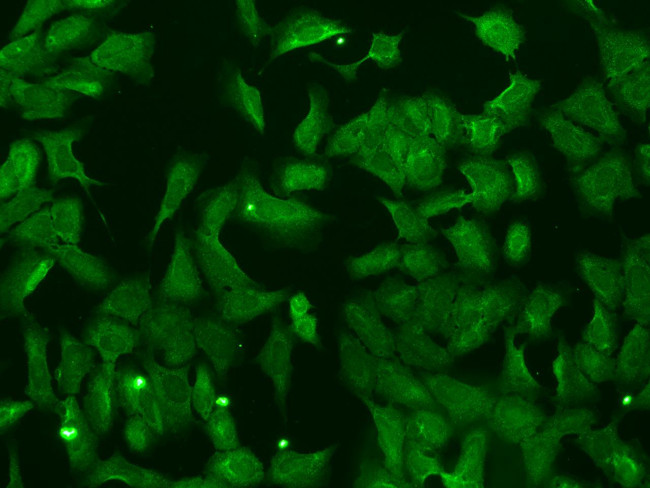 NUDT11 Antibody in Immunocytochemistry (ICC/IF)