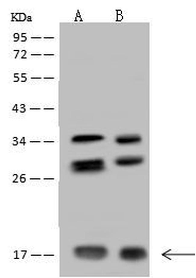 NUDT11 Antibody in Western Blot (WB)