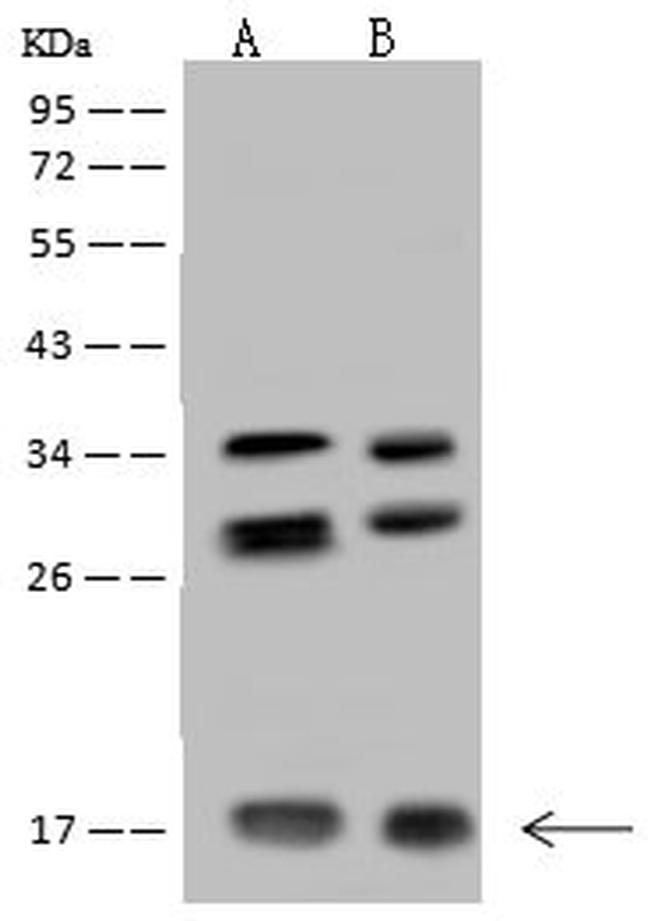 NUDT11 Antibody in Western Blot (WB)