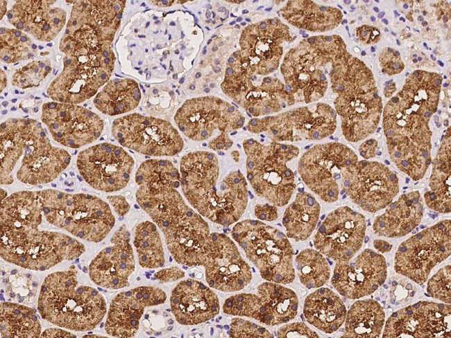 OTUB1 Antibody in Immunohistochemistry (Paraffin) (IHC (P))