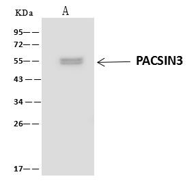 PACSIN3 Antibody in Immunoprecipitation (IP)