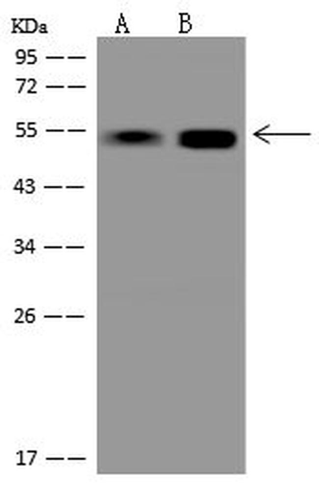 PACSIN3 Antibody in Western Blot (WB)