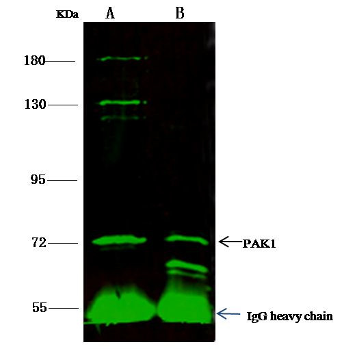 PAK1 Antibody in Immunoprecipitation (IP)