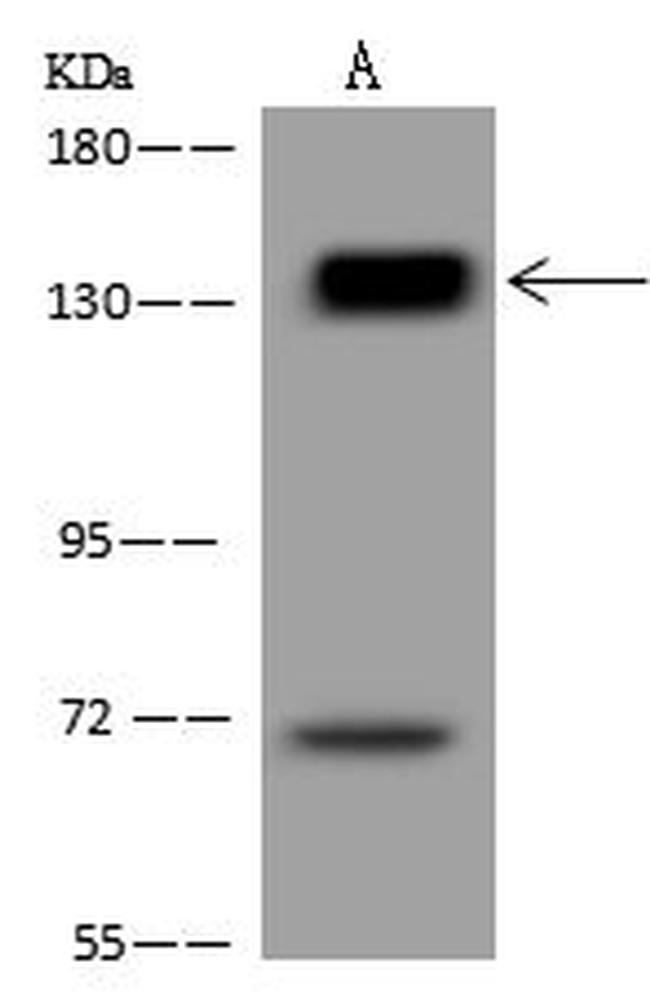 Palladin Antibody in Western Blot (WB)