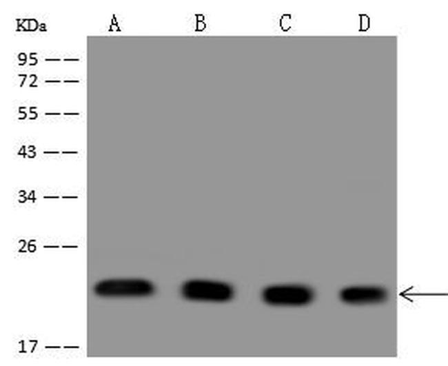 PARK7 Antibody in Western Blot (WB)