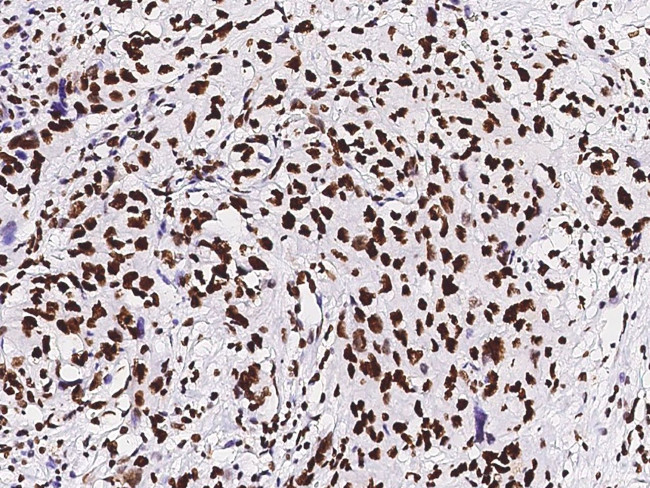 PAX2 Antibody in Immunohistochemistry (Paraffin) (IHC (P))