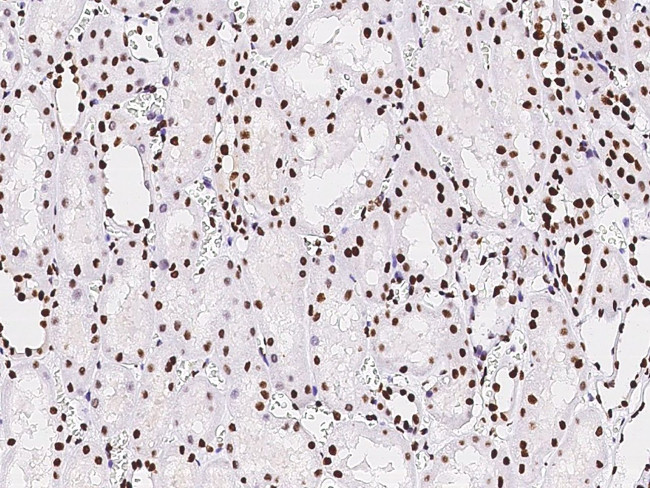 PAX2 Antibody in Immunohistochemistry (Paraffin) (IHC (P))