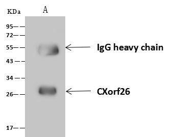 PBDC1 Antibody in Immunoprecipitation (IP)