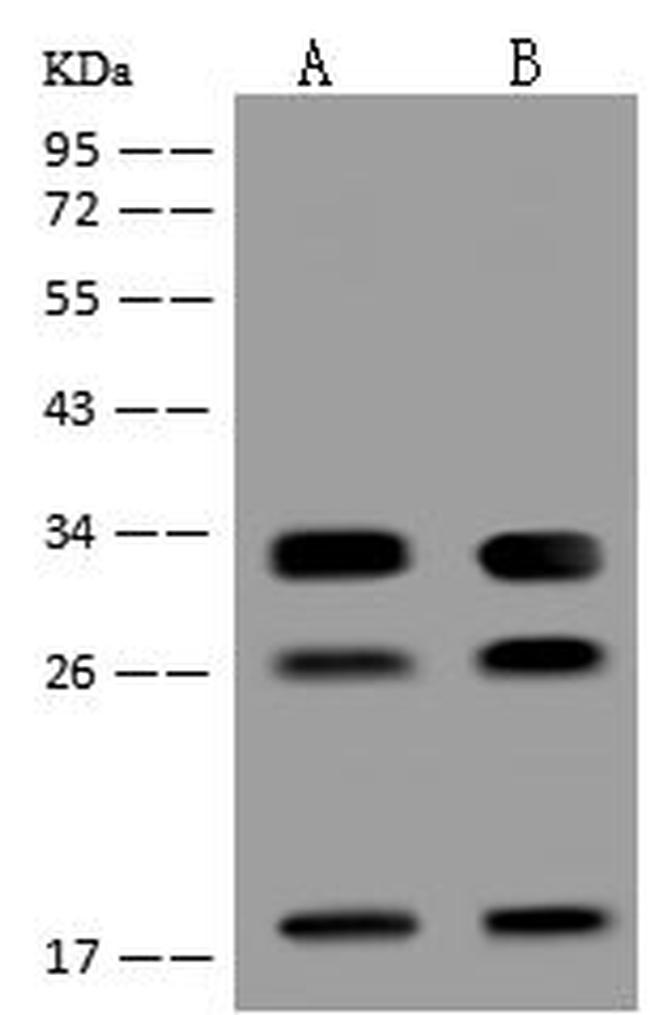 PBDC1 Antibody in Western Blot (WB)