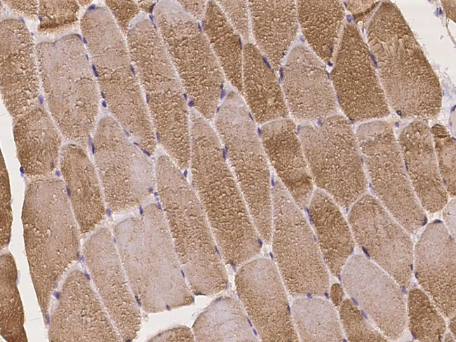 PBXIP1 Antibody in Immunohistochemistry (Paraffin) (IHC (P))