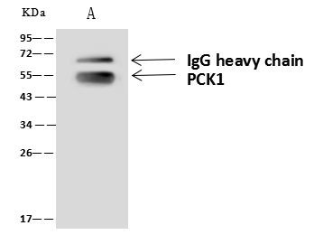 PCK1 Antibody in Immunoprecipitation (IP)