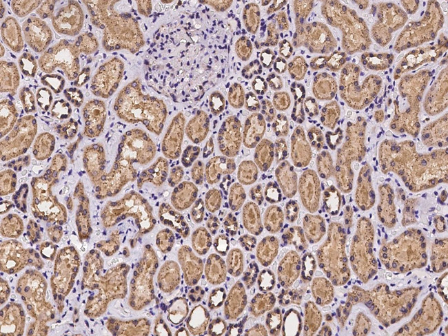 Alix Antibody in Immunohistochemistry (Paraffin) (IHC (P))