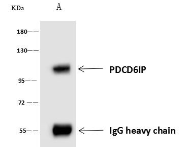 Alix Antibody in Immunoprecipitation (IP)