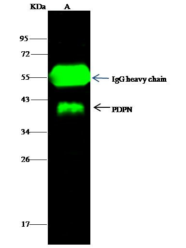 Podoplanin Antibody in Immunoprecipitation (IP)