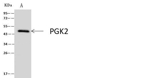 PGK2 Antibody in Immunoprecipitation (IP)