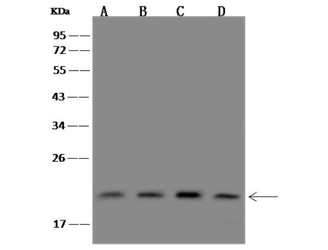 PIGP Antibody in Western Blot (WB)