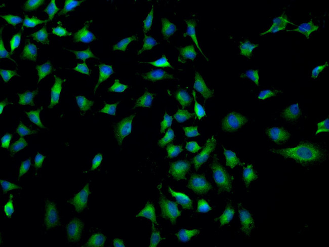 PKD2 Antibody in Immunocytochemistry (ICC/IF)