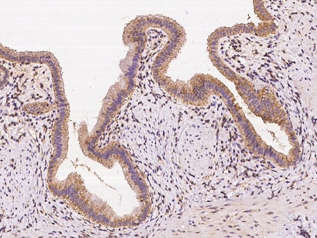 PKD2 Antibody in Immunohistochemistry (Paraffin) (IHC (P))