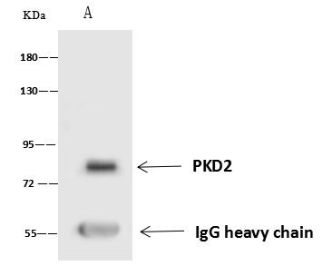 PKD2 Antibody in Immunoprecipitation (IP)