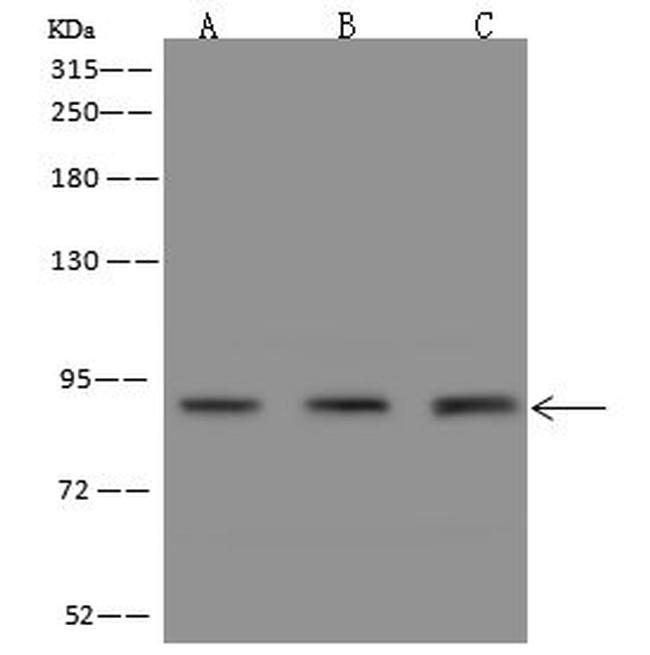 PKD2 Antibody in Western Blot (WB)