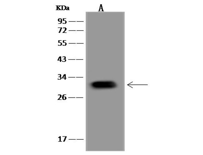 PNMT Antibody in Western Blot (WB)