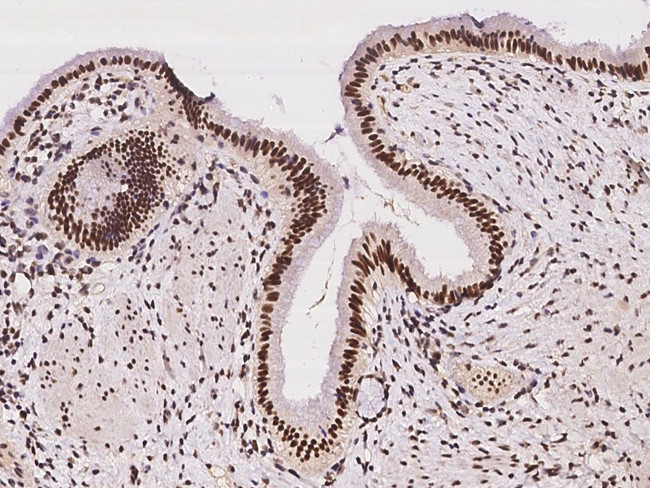 POLB Antibody in Immunohistochemistry (Paraffin) (IHC (P))