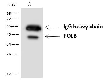 POLB Antibody in Immunoprecipitation (IP)