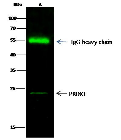 PRDX1 Antibody in Immunoprecipitation (IP)