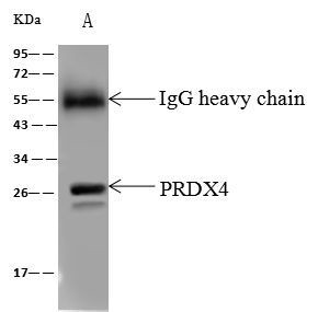 PRDX4 Antibody in Immunoprecipitation (IP)