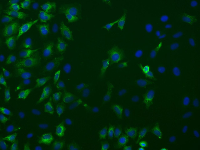 PRKAR1A Antibody in Immunocytochemistry (ICC/IF)